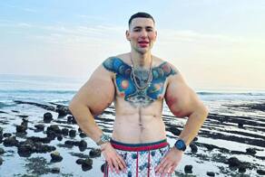 «Рукам-Базукам» грозит ампутация — его руки гниют, а операции делать нельзя