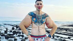 «Рукам-Базукам» грозит ампутация — его руки гниют, а операции делать нельзя